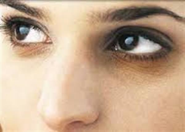 حلقه های سیاه دور چشمانتان را اینگونه از بین ببرید