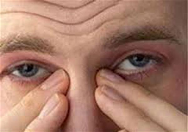 چشم‌رنگی‌ها اضطراب و افسردگی کمتری دارند